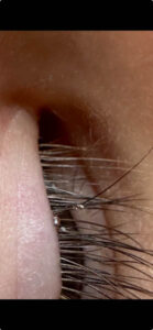 Close-up of a persons eyelid and eyelashes, showing the fine details of the hair and skin texture. A few clear droplets are visible on the eyelashes.