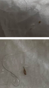 Two close-up photos show a thin, dark hair and a small brown object, possibly a seed or insect, lying on a white textured surface, possibly paper or fabric.