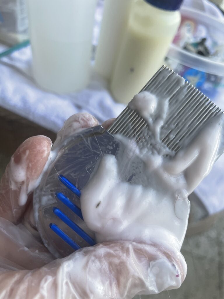 Gloved hands using a professional lice comb during manual head lice removal